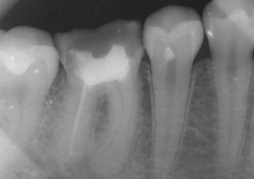中國再生牙齒研究新進(jìn)展，重塑微笑，科技引領(lǐng)牙齒再生新篇章