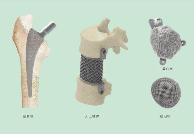 三維打印髖關節(jié)技術(shù)新動態(tài)，重塑生活的科技魔法奇跡
