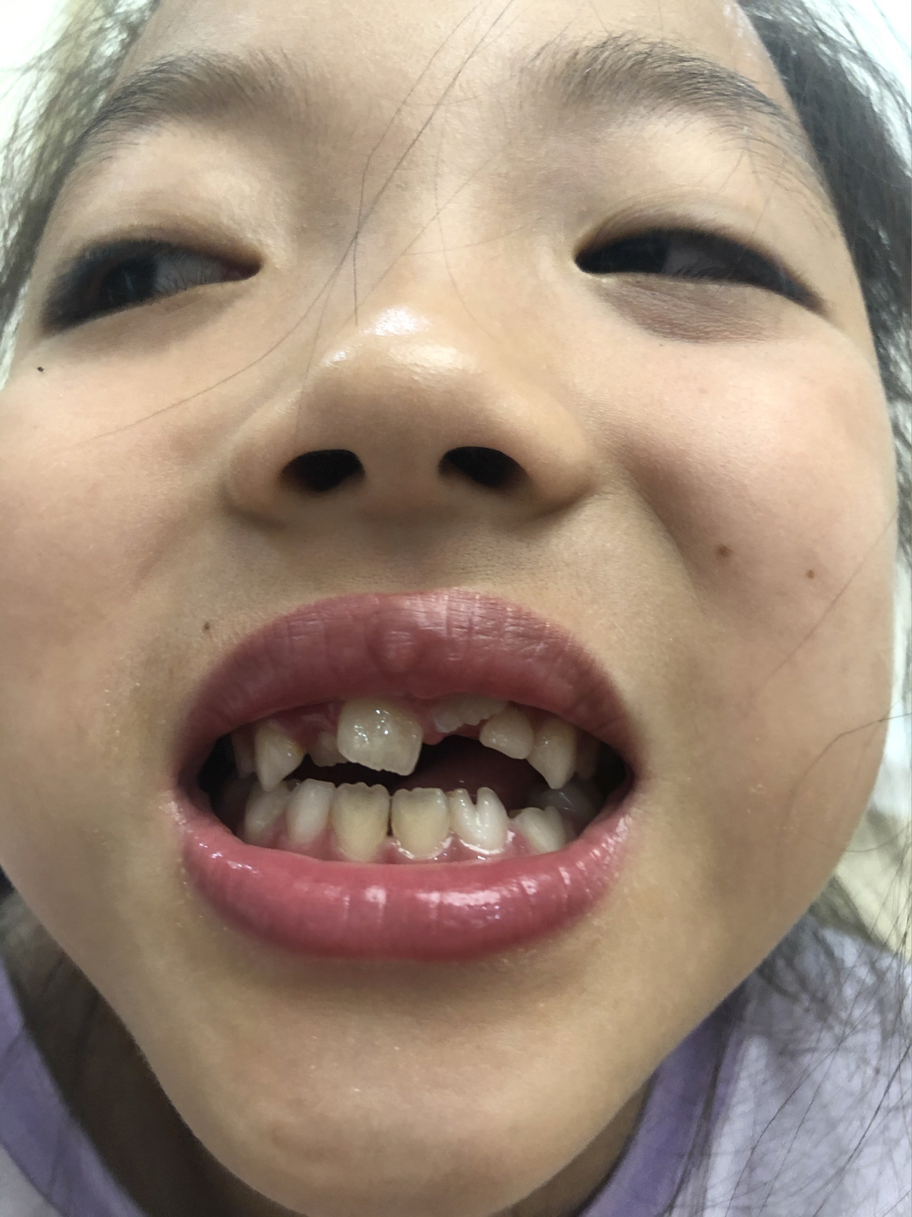 莊最新牙齒技術(shù)揭秘，牙齒美容新選擇