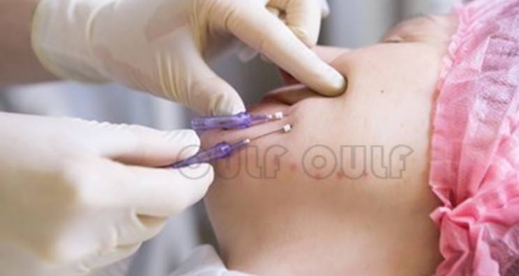 線雕最新手法，背景、發(fā)展、時代地位及展望